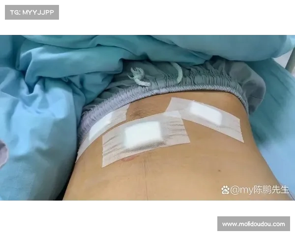 弗拉泰西将在几天内接受手术治疗 彻底解决困扰已久的疝气问题 弗拉泰西将在几天内接受手术治疗 彻底解决困扰已久的疝气问题